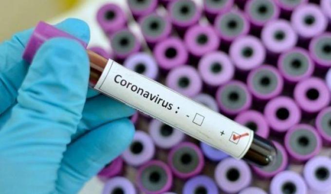 На Луганщині лабораторно підтверджено 14 нових випадків COVID-19