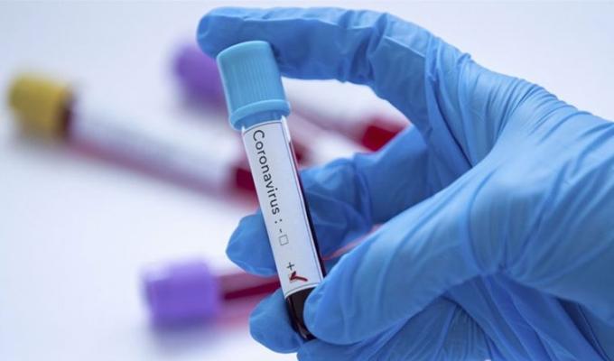 Лабораторно підтверджено 74 нових випадки COVID-19 в області