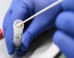Лабораторно підтверджено 83 нових випадки COVID-19 в області за минулу добу. Від ускладнень померло ще 11 хворих