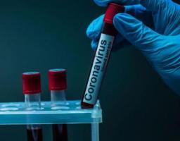 Лабораторно підтверджено три нових випадки COVID-19 в області