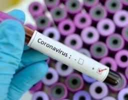 Лабораторно підтверджено 71 новий випадок COVID-19 за добу в області. В Україні померло ще 256 осіб 